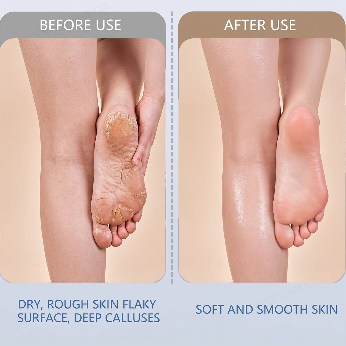 Electric Foot File Ð Rechargeable Callus Remover | AuriGlam