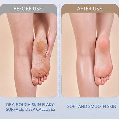 Electric Foot File Ð Rechargeable Callus Remover | AuriGlam